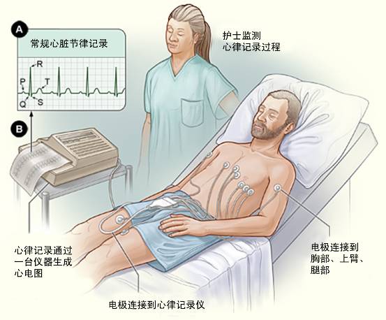 冠心病需要做哪些檢查？(圖1)